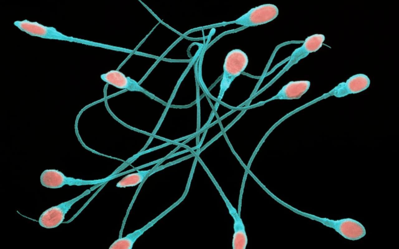 Sperm Positive is the first sperm bank for HIV positive people. Image via Science Photo Library.