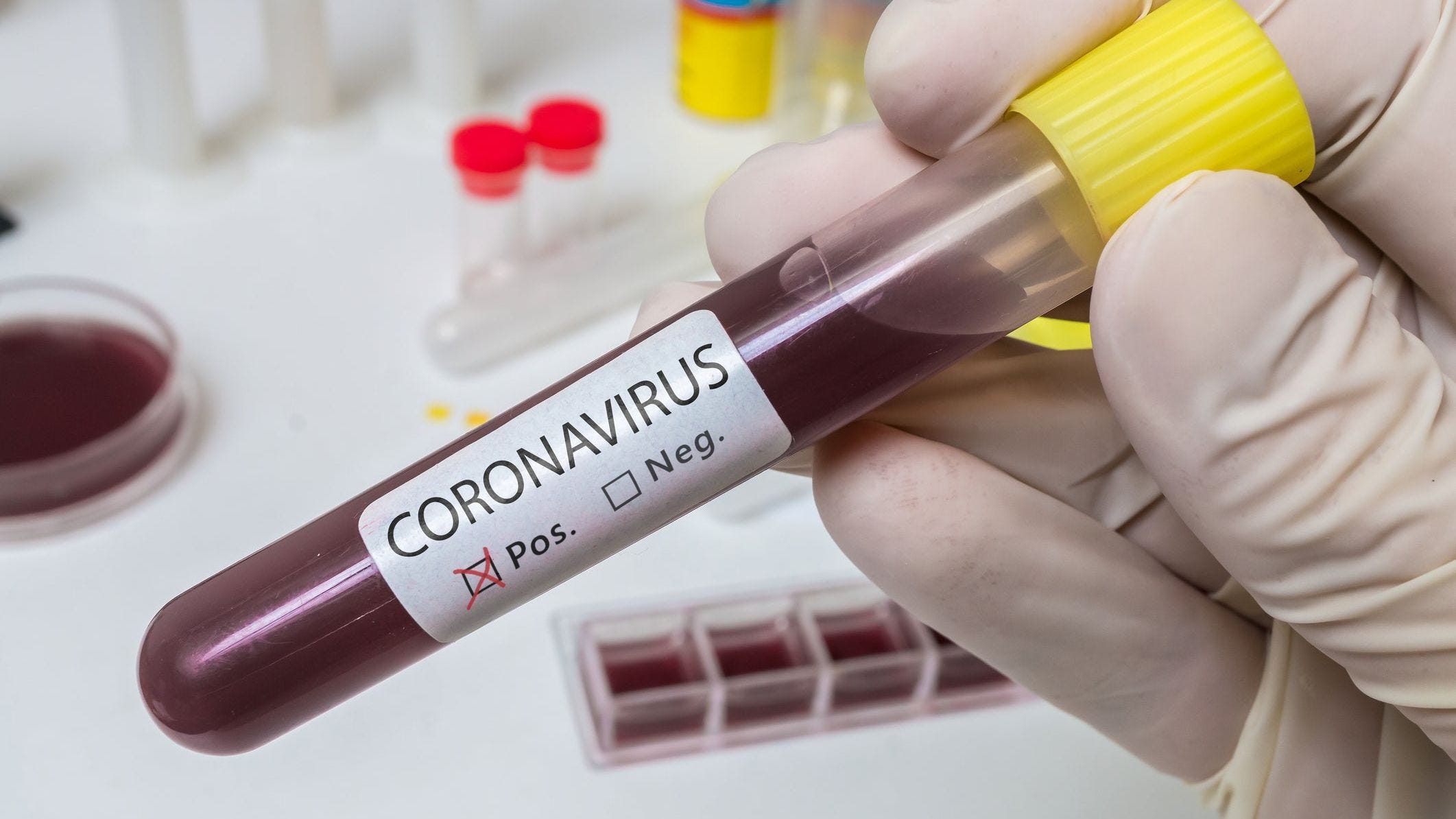 Experimental coronavirus drug remdesivir to be distributed again after halt a week ago